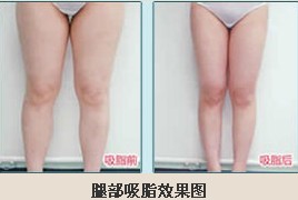 ˮ�����h(hu��n)����֬���g(sh��)Ч���D