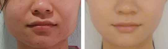 ���~���������g(sh��)Ч���D