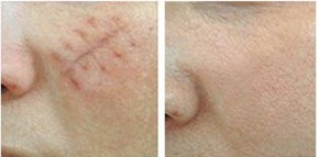 �����԰̺��ޏ�(f��)���g(sh��)Ч���D