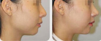 �Ǽ����ΰ���