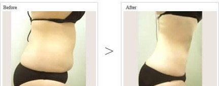 ������֬���g(sh��)Ч���D