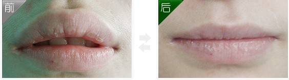 ��׃���g(sh��)���g(sh��)Ч���D