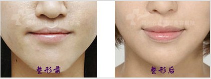 ���w֬���S���g(sh��)���g(sh��)Ч���D