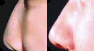 �Ǽ��ƽ�����g(sh��)���g(sh��)Ч���D