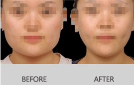 V-LINE�ķ�Ę�����g(sh��)���g(sh��)Ч���D