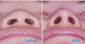 ¡�����g(sh��)�ɹ�����