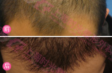 �^�l(f��)��ֲ���g(sh��)�ɹ�����