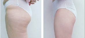 360��ˮ������λ��֬�ɹ�����