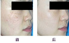 ��������g�ɹ����gЧ���D