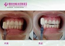 ���X����Ч���D