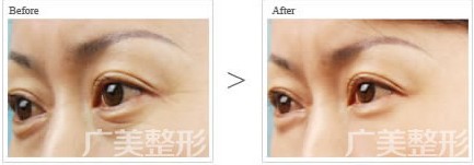 ��������۴����g(sh��)Ч���D