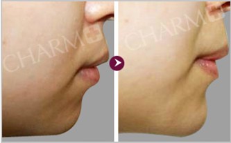 ��ؐܽ�S�°����gЧ���D