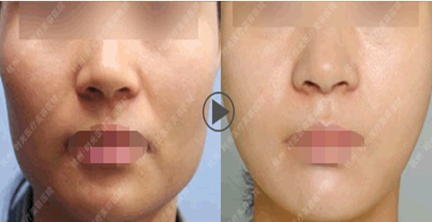 ��Ę�����g(sh��)Ч���D