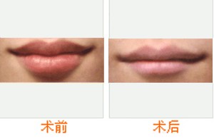 �����ı��ĳɹ�����