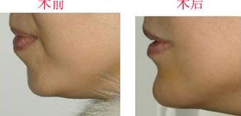 �������S�°ͳɹ�����