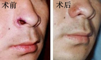 �ǲ�ȱ�p����ĳɹ�����