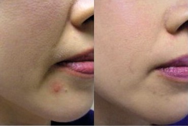 ��ؐܽ�����ɹ�����