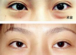 �۲���֬�g(sh��)�ĳɹ�����