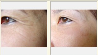 ע������ɹ�����