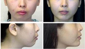 ע�����γɹ�����