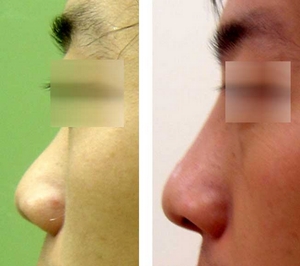 3Dȫ�����γɹ�����