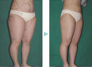 ��֬ᘳɹ�����