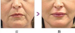 ����������g(sh��)�ɹ��İ���