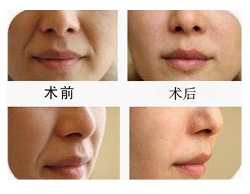 3D�沿�����ĳɹ�����