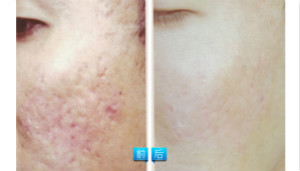 �������}�_�c(di��n)������挍(sh��)����