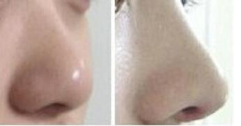 �����nʽ�{�׷���¡���g(sh��)���挍����