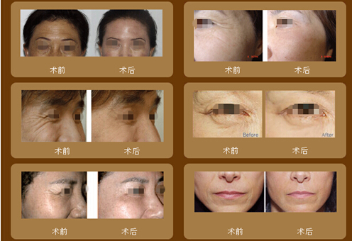 �N�ϡ���ħŮ����(bi��o)�������ܕr(sh��)�⵹���ġ�������