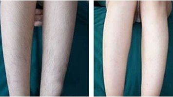 ����׌�Óë��g��(ji��)