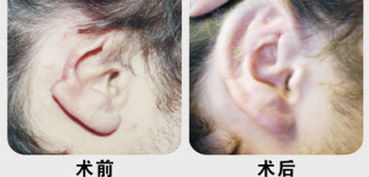 �˻������Π�r��ô�γɵ���Ҫ���׃����