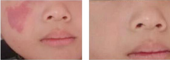 ̥ӛ��ʲô�t(y��)�W(xu��)�k��̎����