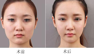 北京东方和谐医疗美容诊所整形案例