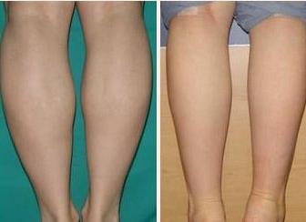 ��С�ȵ��挍����