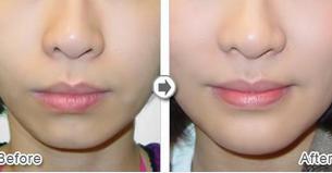 ¡�°ͳɹ�����