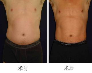 360����֬���g(sh��)�ɹ�����