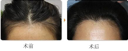 �l(f��)�H���Nֲ�ɹ�����