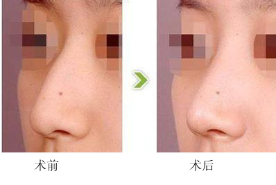 ���^�ǳC���ɹ�����