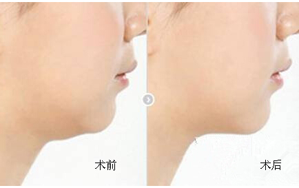 ���W֬������Ч���D