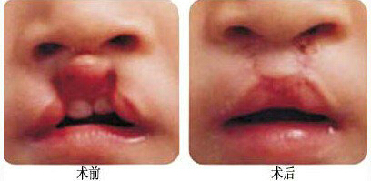 �����ޏ�Ч���D