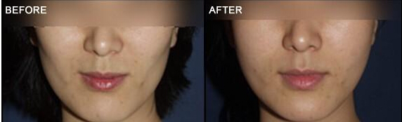 ���a�����ɹ�����