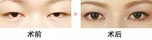 �p��Ƥ���g(sh��)���ư˴��۲���(w��n)�}���S�٘s���ڽ���