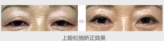 �p��Ƥ���g(sh��)���ư˴��۲���(w��n)�}���S�٘s���ڽ���