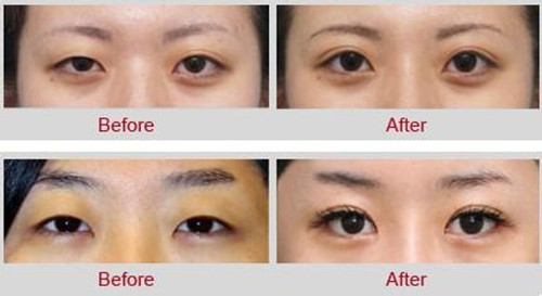 �p��Ƥ���g(sh��)���ư˴��۲���(w��n)�}���S�٘s���ڽ���