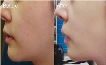 ������ע��ĳɹ�����