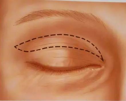 �D�����_�p��Ƥ���g(sh��)ȫ�^��