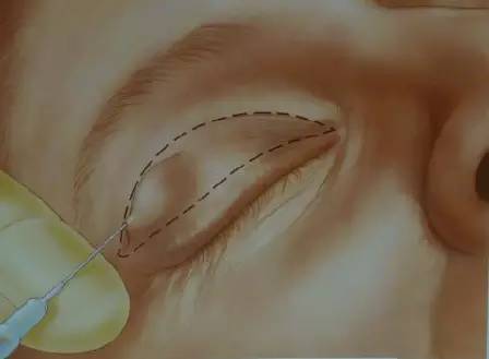 �D�����_�p��Ƥ���g(sh��)ȫ�^��