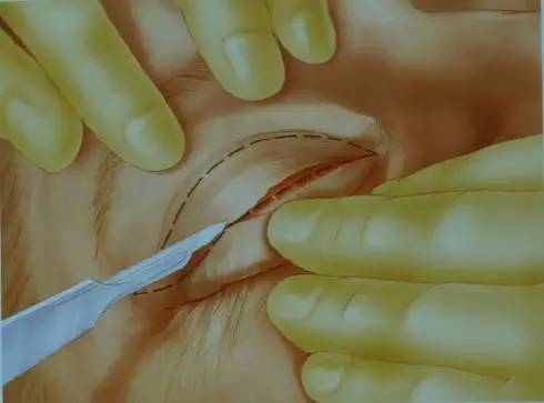 �D�����_�p��Ƥ���g(sh��)ȫ�^��